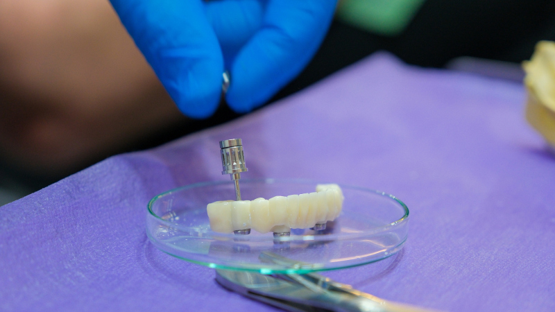 Restorative Dentistry in Toronto, Ontario