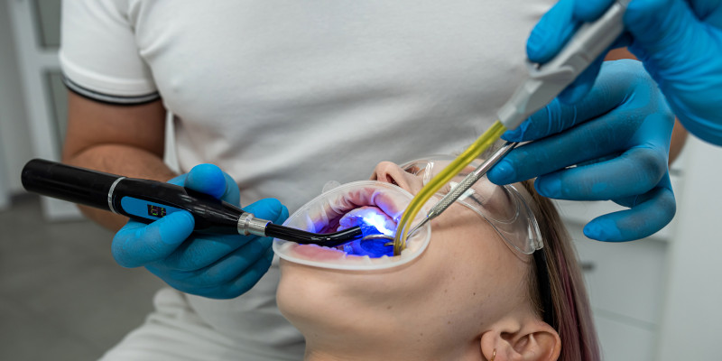 Tooth Fillings in Toronto, Ontario