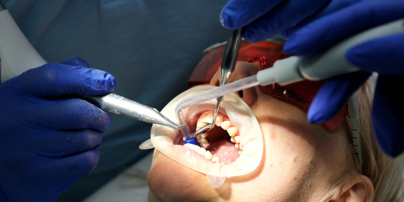 Emergency Dentist in Toronto, Ontario