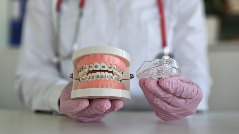 Invisalign in Toronto, Ontario