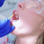 Fluoride Treatments