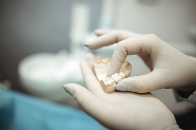 Tooth Bonding, Toronto, ON | Dentistry by the Lake